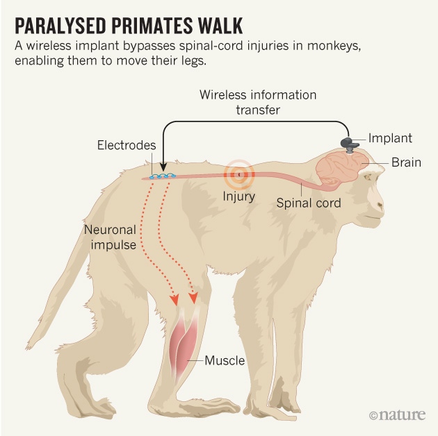 A wireless implant bypasses spinal-cord injuries in monkeys, enabling them to move their legs.