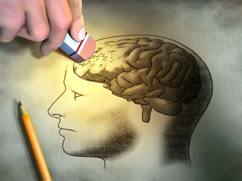 Someone is erasing a drawing of the human brain. Conceptual image relating to dementia and memory loss. Digital illustration.